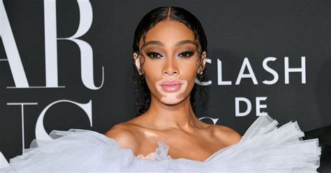 winnie harlow net worth|Winnie Harlow